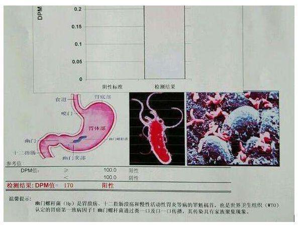 告别幽门螺杆菌！教你用温水杀菌远离致命病菌！冷IM电竞饮畅快享受！(图2)